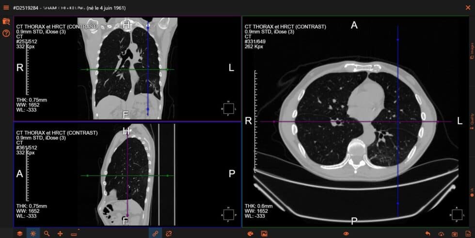 Innovative RIS PACS for all radiologist's needs — Evolucare