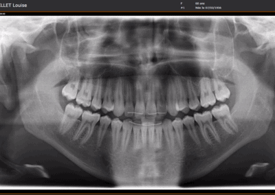 Imaging : PACS