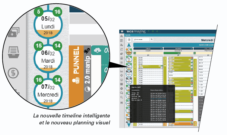 La timeline Evolucare Imaging pour les rendez-vous