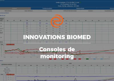 Innovations Biomed : la console de monitoring Evolucare