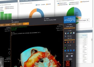Imaging : RIS PACS