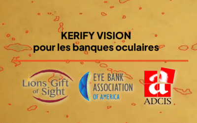 Lancement de Kerify Vision, une révolution dans la banque des yeux
