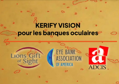 Lancement de Kerify Vision, une révolution dans la banque des yeux