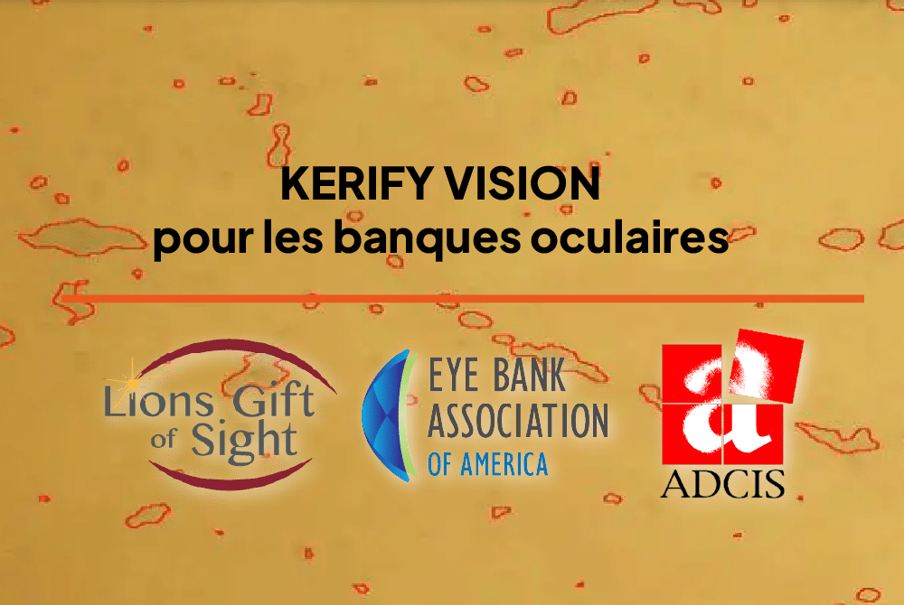 Lancement de Kerify Vision, une révolution dans la banque des yeux