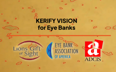 Launch of Kerify Vision, a revolution in eye banking