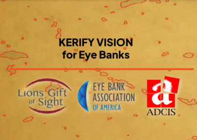 Launch of Kerify Vision, a revolution in eye banking