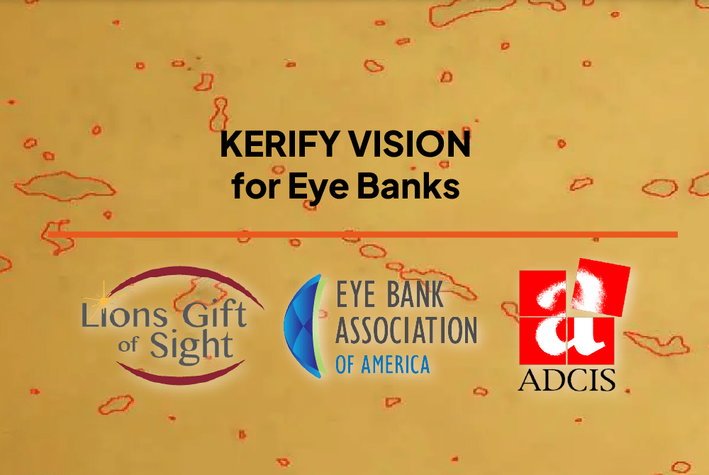 kerify vision eye banks