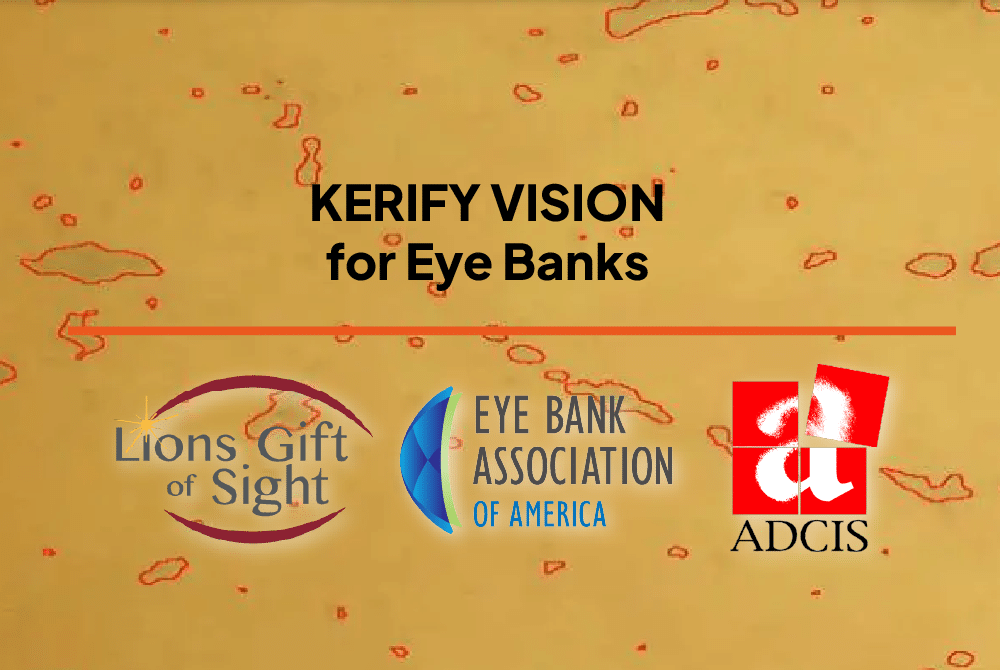 Launch of Kerify Vision, a revolution in eye banking