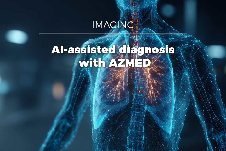 Azmed Imaging Detection En 80